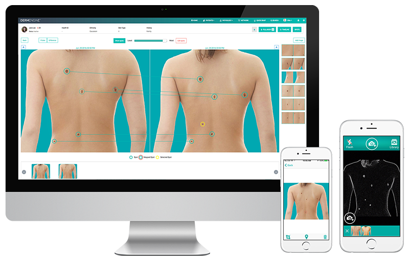 Total Body Photography