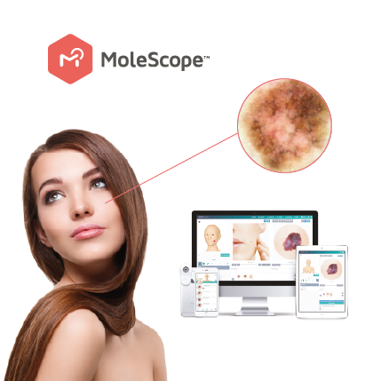 MoleScope